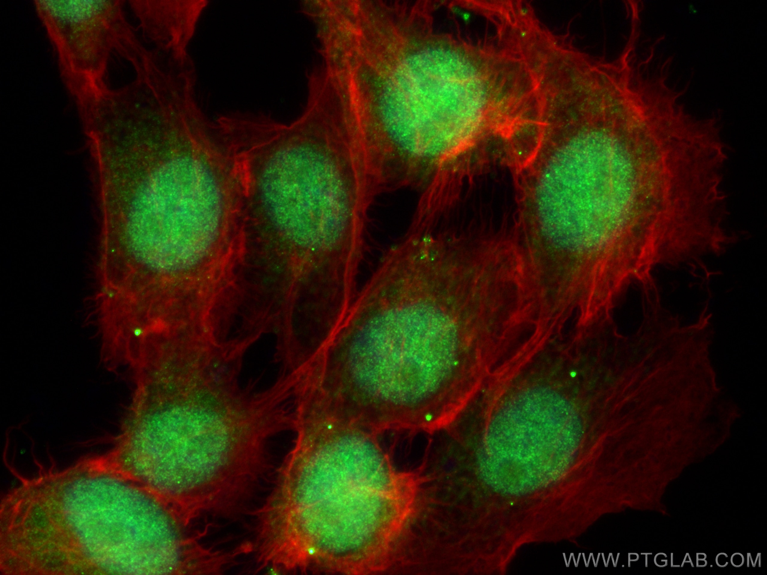 Immunofluorescence (IF) / fluorescent staining of A431 cells using OGG1 Polyclonal antibody (15125-1-AP)