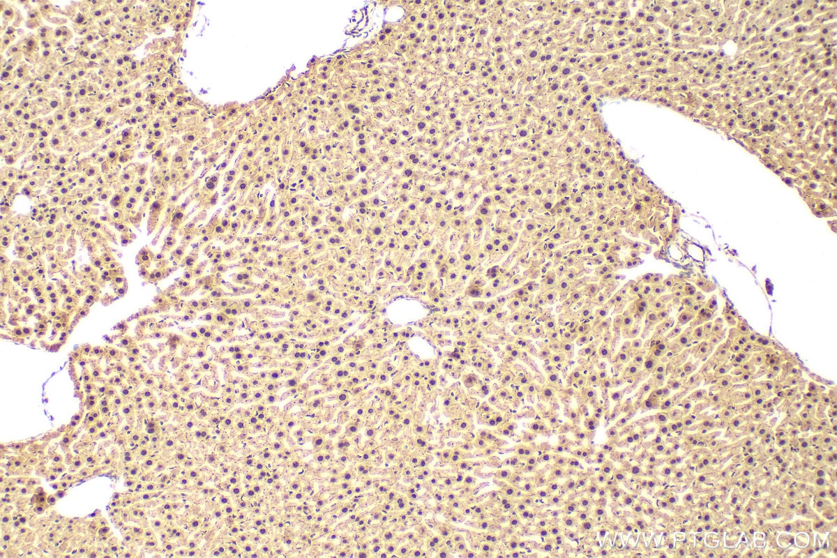 Immunohistochemistry (IHC) staining of mouse liver tissue using OGG1 Polyclonal antibody (15125-1-AP)