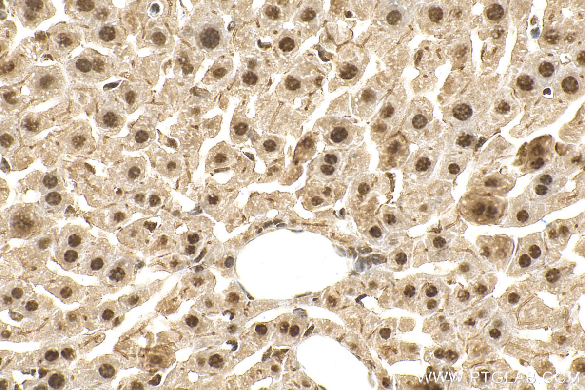 Immunohistochemistry (IHC) staining of mouse liver tissue using OGG1 Polyclonal antibody (15125-1-AP)