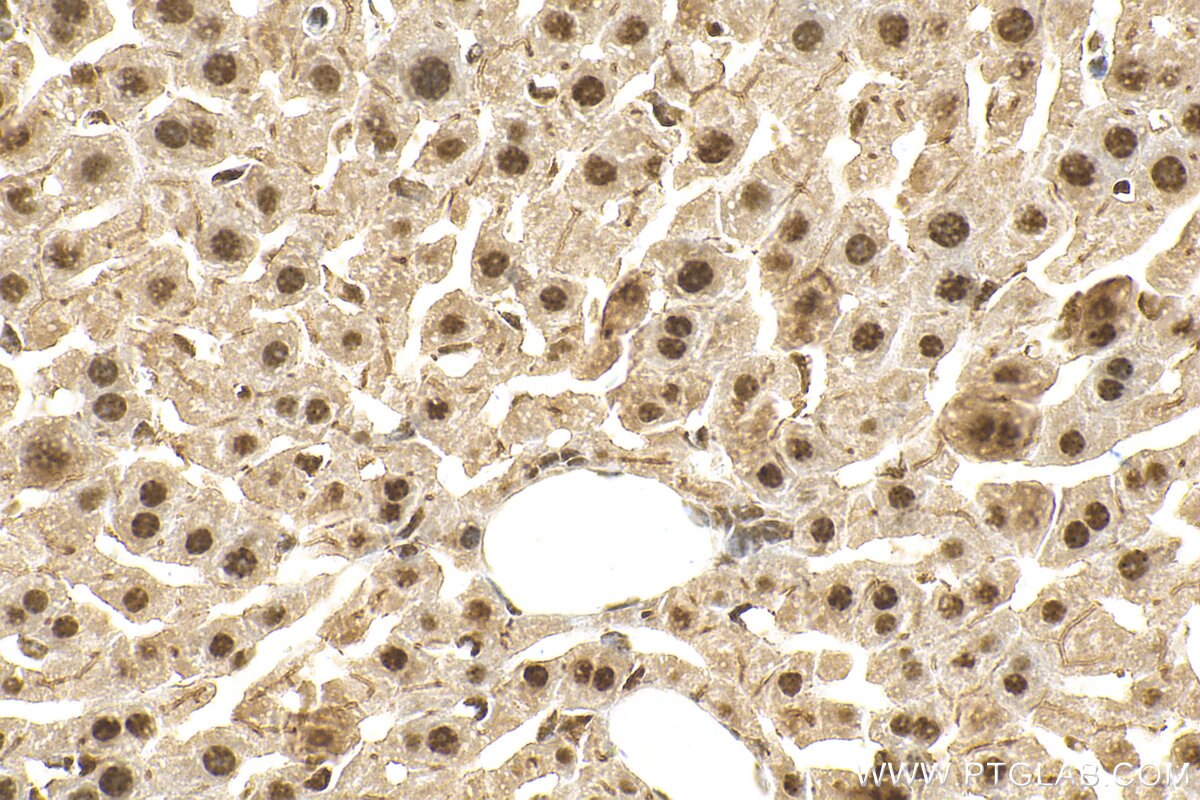 IHC staining of mouse liver using 15125-1-AP