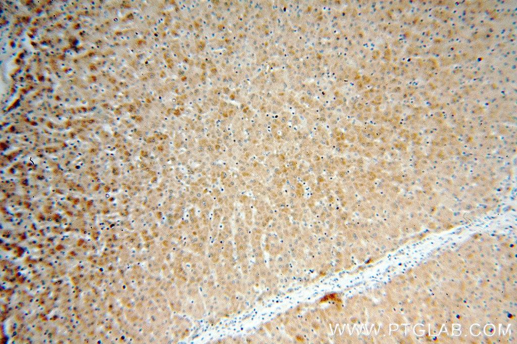 Immunohistochemistry (IHC) staining of human liver tissue using OGG1 Polyclonal antibody (15125-1-AP)