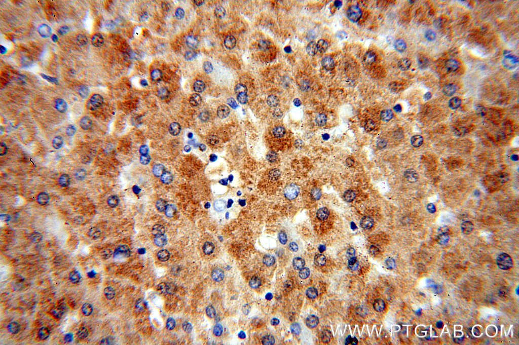 Immunohistochemistry (IHC) staining of human liver tissue using OGG1 Polyclonal antibody (15125-1-AP)