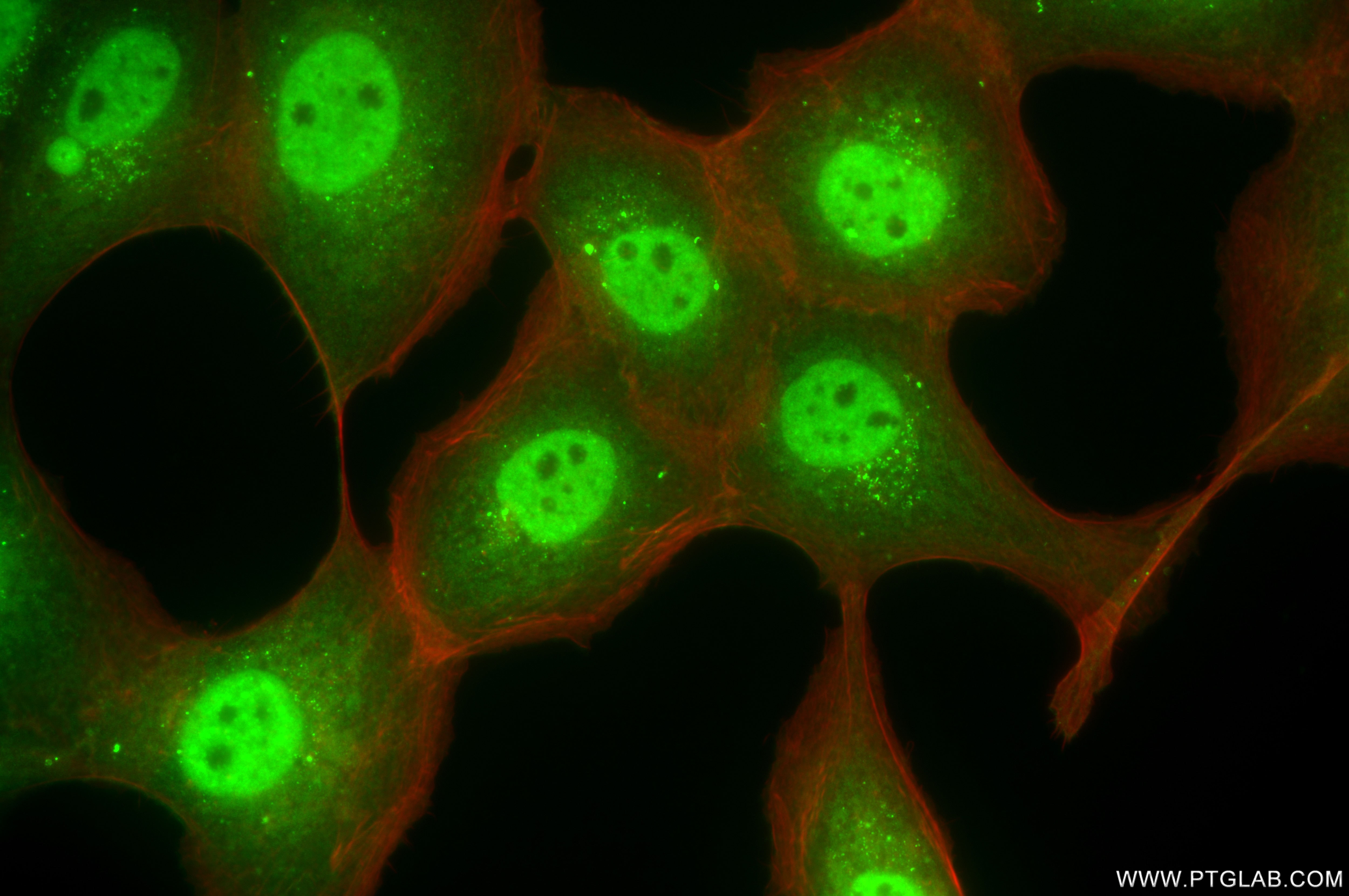 Immunofluorescence (IF) / fluorescent staining of A431 cells using OGG1 Recombinant antibody (83973-5-RR)
