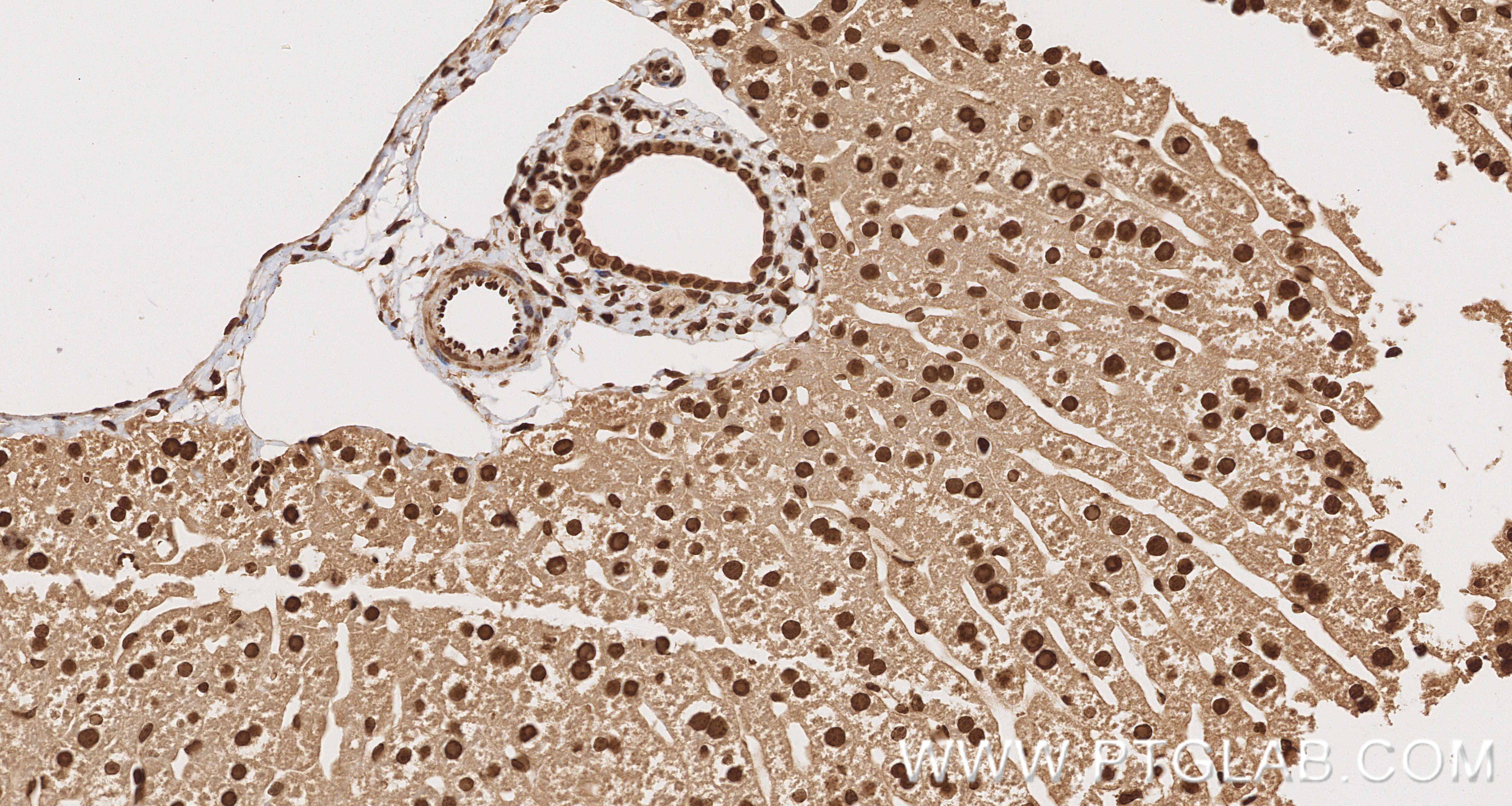 Immunohistochemical analysis of paraffin-embedded mouse liver tissue slide using 83973-5-RR (OGG1 antibody) at dilution of 1:1000 (under 40x lens). Heat mediated antigen retrieval with Tris-EDTA buffer (pH 9.0). Immunohistochemistry (IHC) staining of mouse liver tissue using OGG1 Recombinant monoclonal antibody (83973-5-RR)
