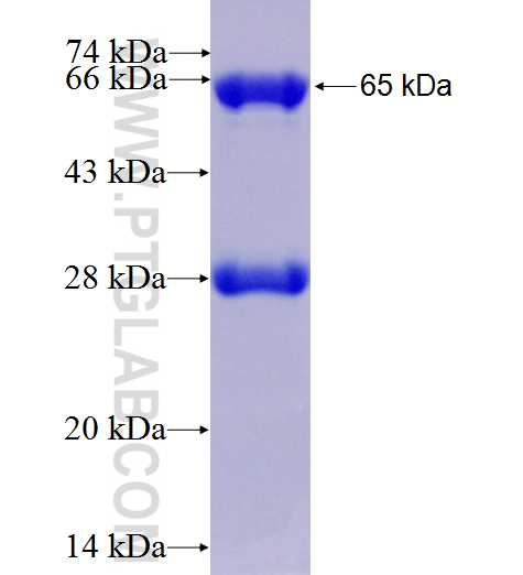 OGG1 fusion protein Ag7204 SDS-PAGE