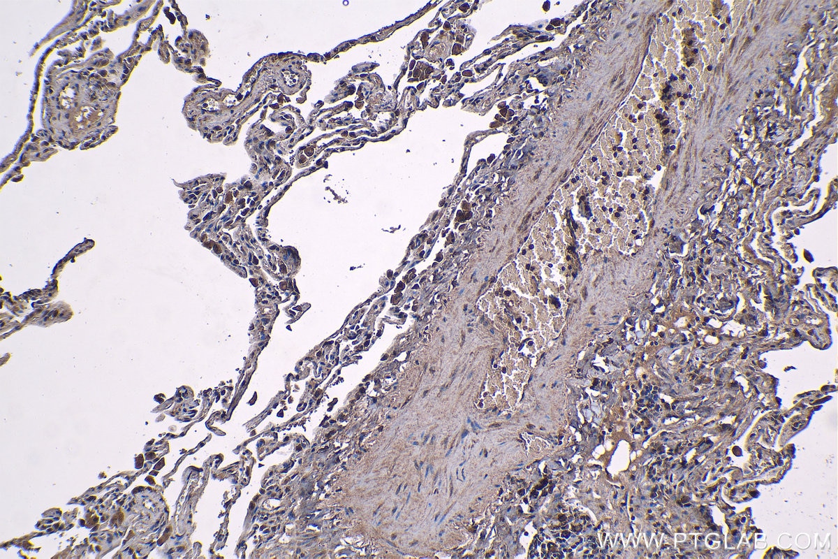 Immunohistochemistry (IHC) staining of human lung tissue using Osteoglycin Polyclonal antibody (12755-1-AP)