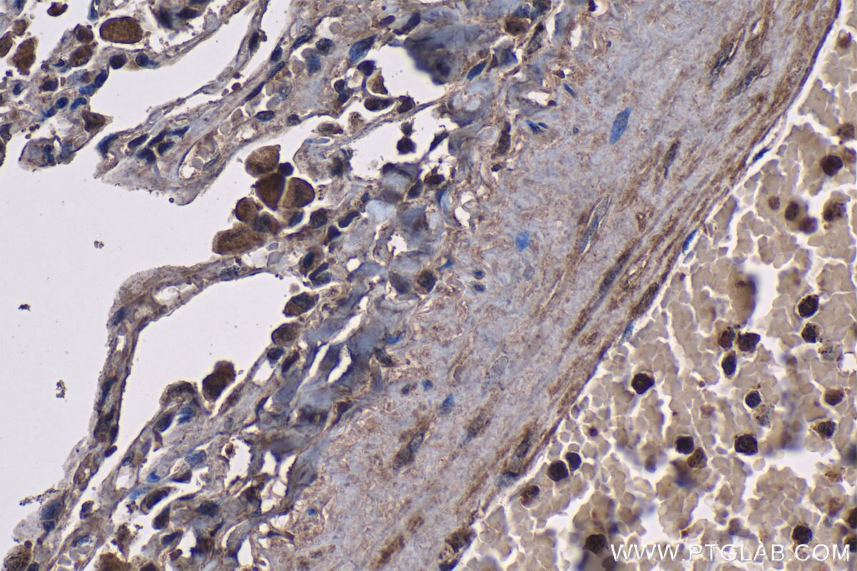 Immunohistochemistry (IHC) staining of human lung tissue using Osteoglycin Polyclonal antibody (12755-1-AP)