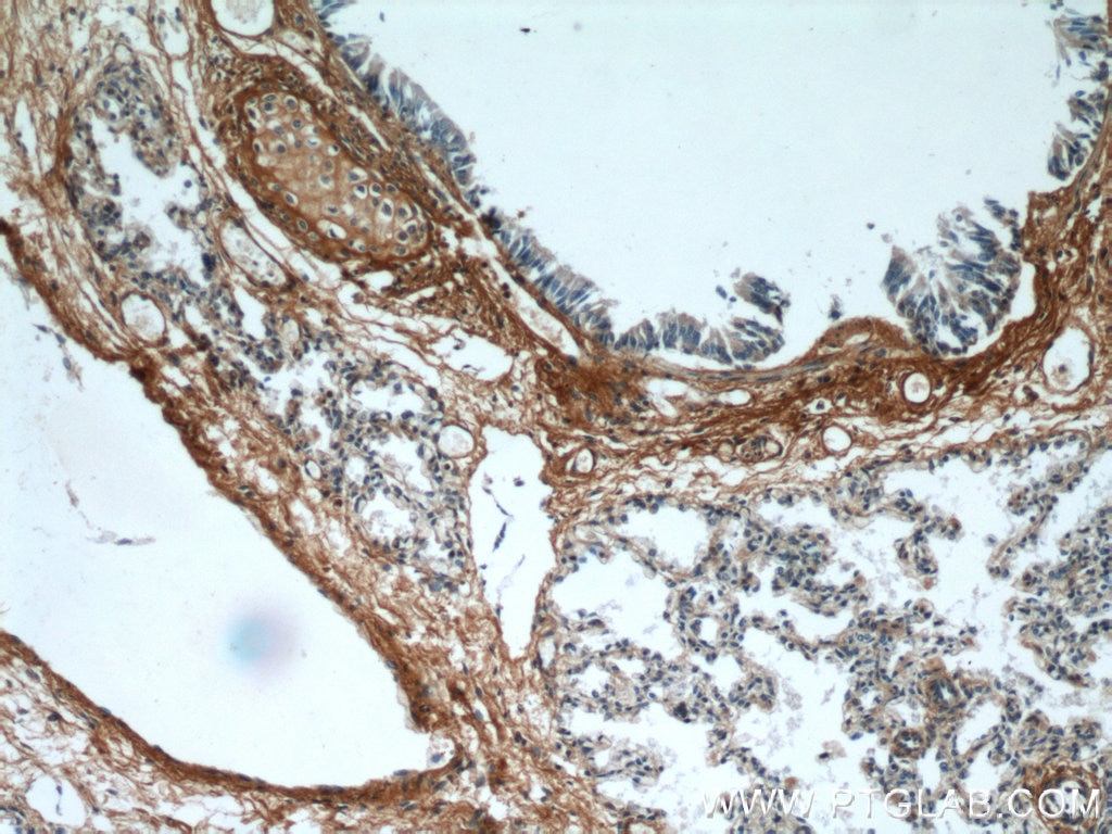 IHC staining of human lung using 12755-1-AP