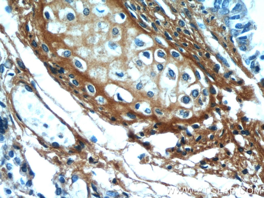Immunohistochemistry (IHC) staining of human lung tissue using Osteoglycin Polyclonal antibody (12755-1-AP)