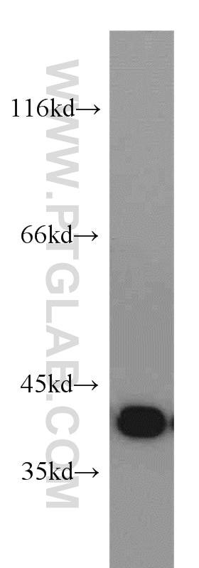 Western Blot (WB) analysis of HeLa cells using Osteoglycin Polyclonal antibody (12755-1-AP)