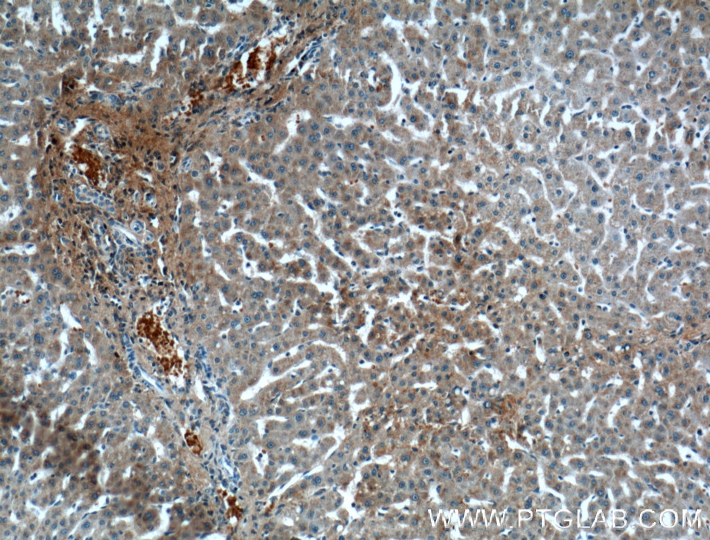 Immunohistochemistry (IHC) staining of human liver tissue using OGN Monoclonal antibody (66382-1-Ig)