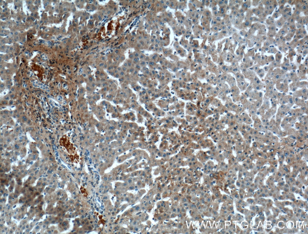 Immunohistochemistry (IHC) staining of human liver tissue using Osteoglycin Monoclonal antibody (66382-1-Ig)