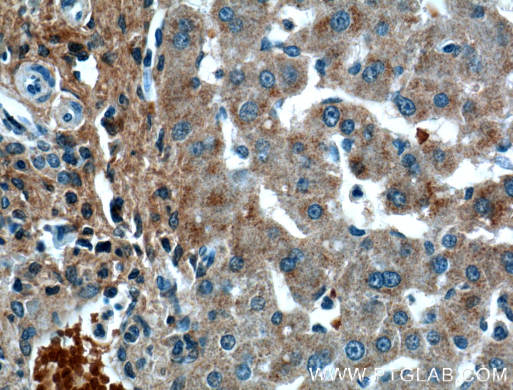 Immunohistochemistry (IHC) staining of human liver tissue using Osteoglycin Monoclonal antibody (66382-1-Ig)