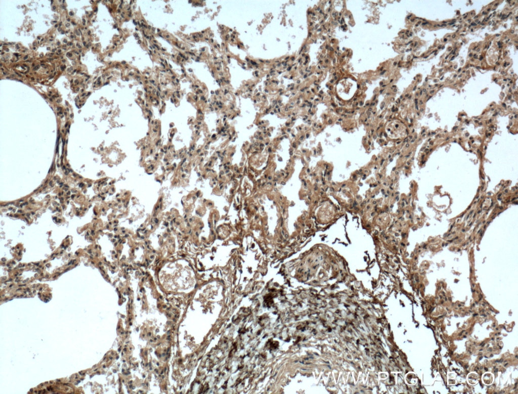 Immunohistochemistry (IHC) staining of human lung tissue using Osteoglycin Monoclonal antibody (66382-1-Ig)