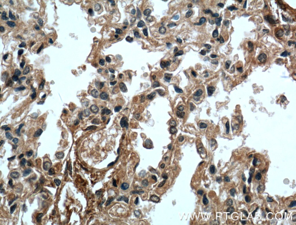 Immunohistochemistry (IHC) staining of human lung tissue using OGN Monoclonal antibody (66382-1-Ig)