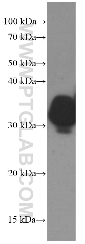 Western Blot (WB) analysis of human artery tissue using OGN Monoclonal antibody (66382-1-Ig)