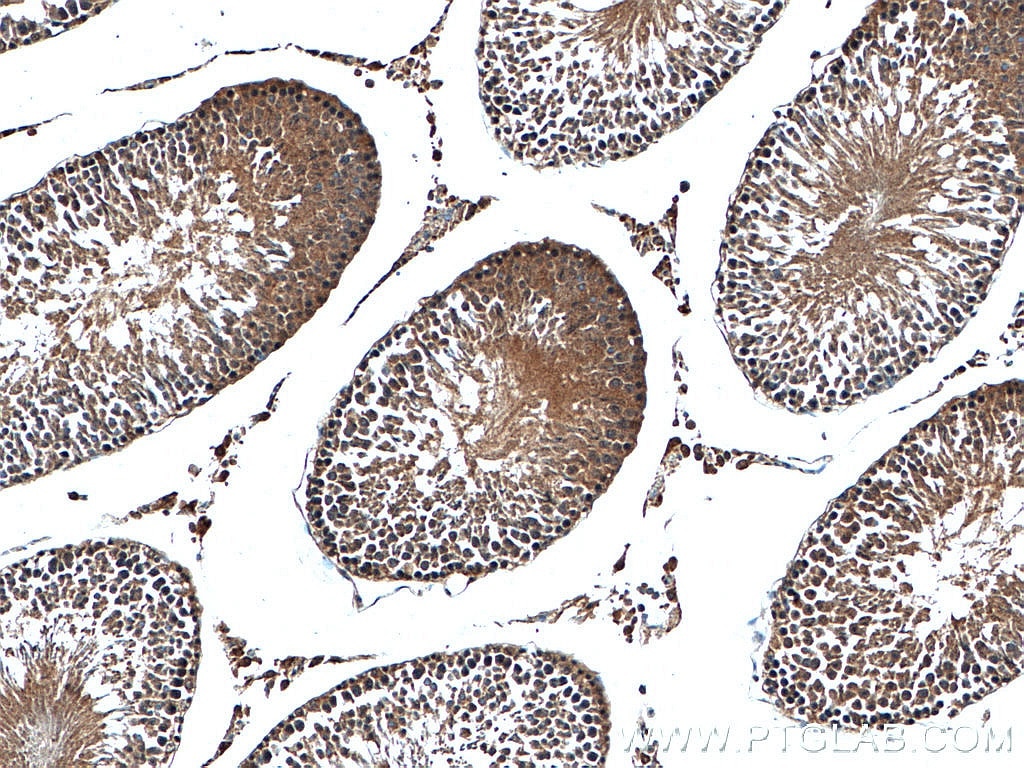 Immunohistochemistry (IHC) staining of rat testis tissue using OGT Polyclonal antibody (11576-2-AP)