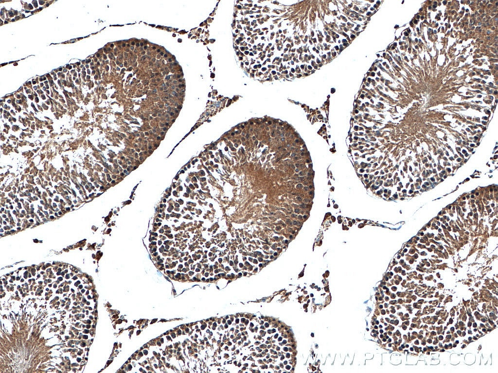 IHC staining of rat testis using 11576-2-AP