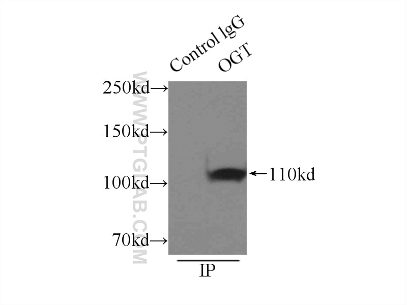 Immunoprecipitation (IP) experiment of mouse brain tissue using OGT Polyclonal antibody (11576-2-AP)