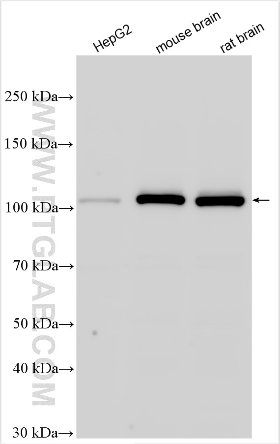 Western Blot (WB) analysis of various lysates using OGT Polyclonal antibody (11576-2-AP)