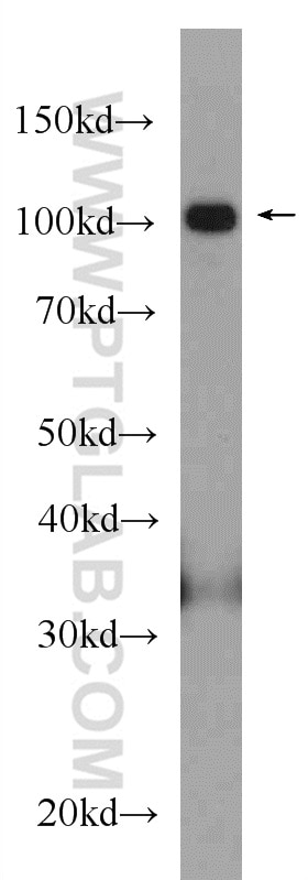 Western Blot (WB) analysis of mouse liver tissue using OGT Polyclonal antibody (11576-2-AP)
