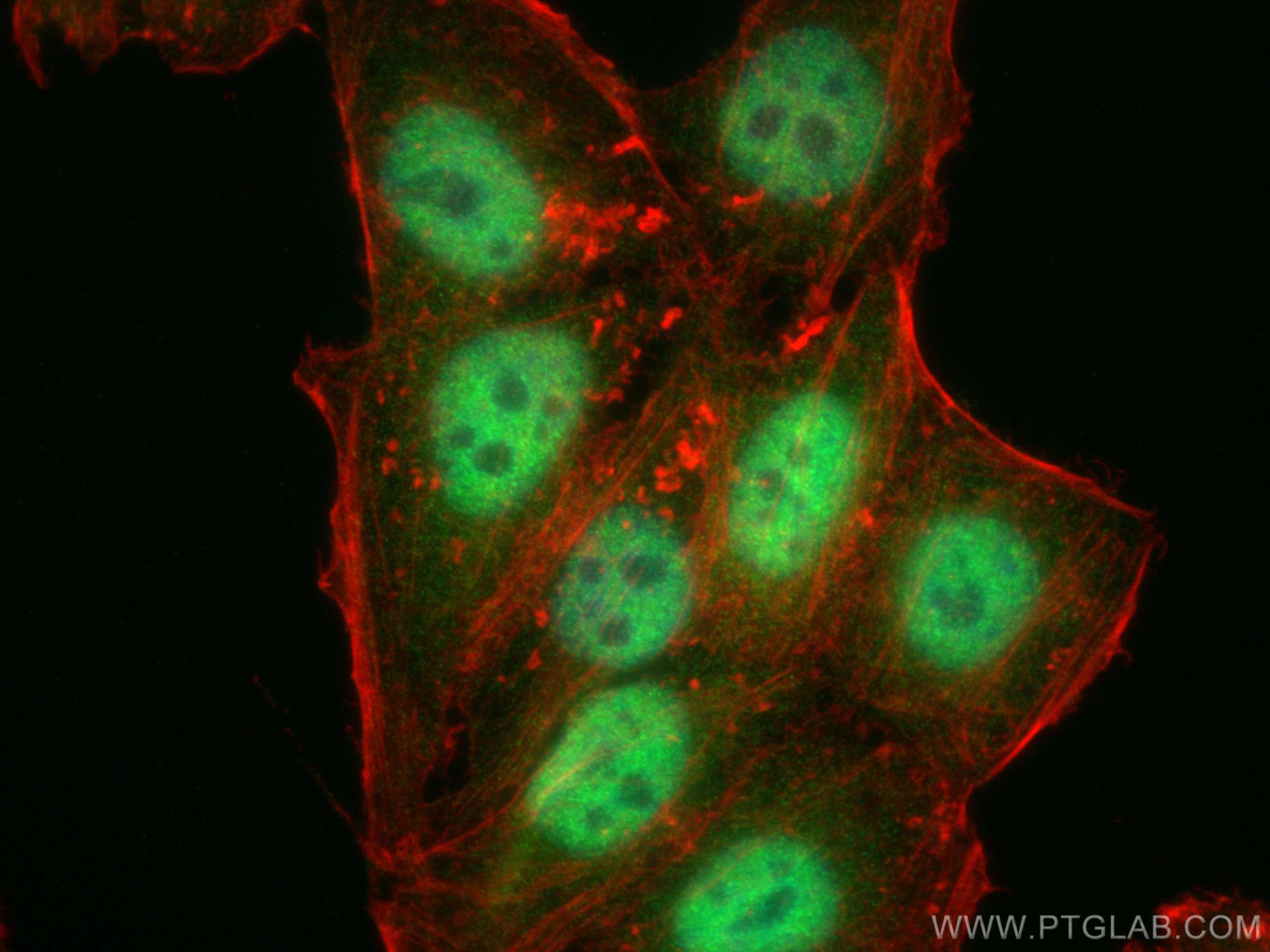 Immunofluorescence (IF) / fluorescent staining of HepG2 cells using OGT Monoclonal antibody (66823-1-Ig)