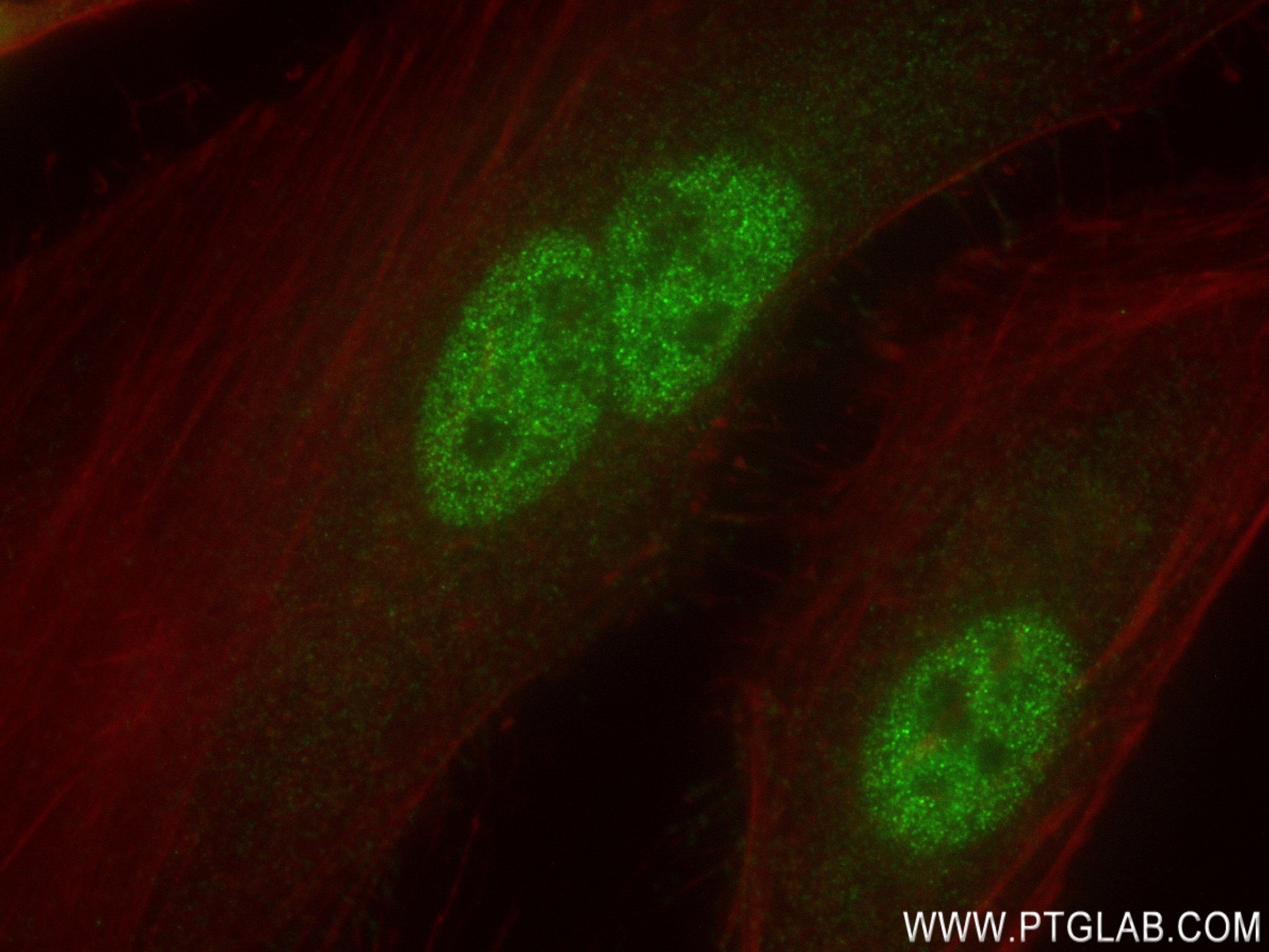 Immunofluorescence (IF) / fluorescent staining of HeLa cells using OGT Recombinant antibody (83113-1-RR)