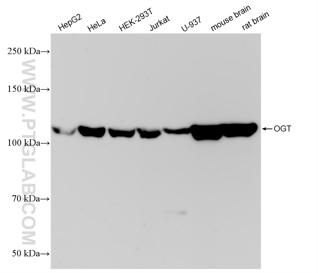 Western Blot (WB) analysis of various lysates using OGT Recombinant antibody (83113-1-RR)