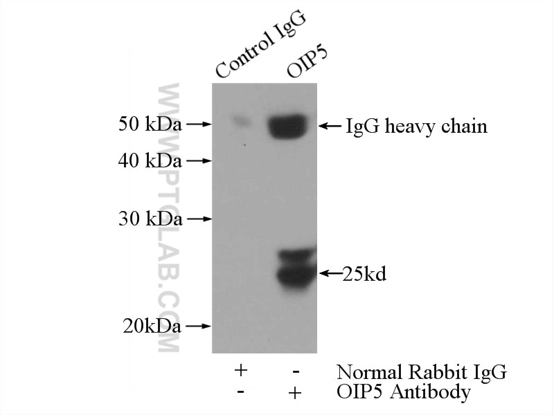 Immunoprecipitation (IP) experiment of Jurkat cells using OIP5 Polyclonal antibody (12142-1-AP)