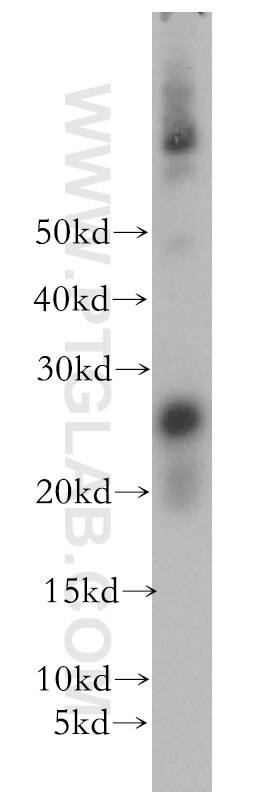 OIP5 Polyclonal antibody