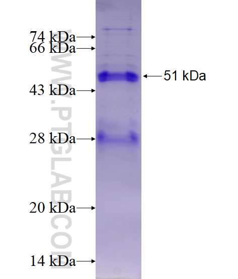 OIP5 fusion protein Ag2790 SDS-PAGE