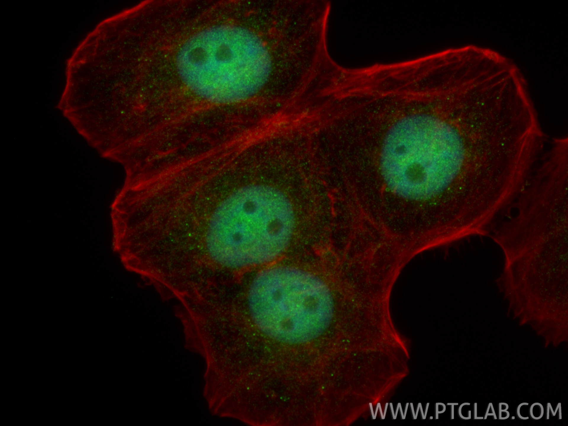 IF Staining of A431 using 32301-1-AP Immunofluorescence (IF) / fluorescent staining of A431 cells using OIT3 Polyclonal antibody (32301-1-AP)