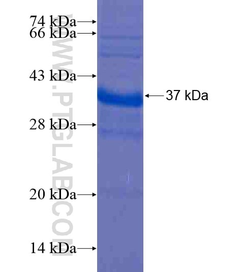 OIT3 fusion protein Ag20421 SDS-PAGE