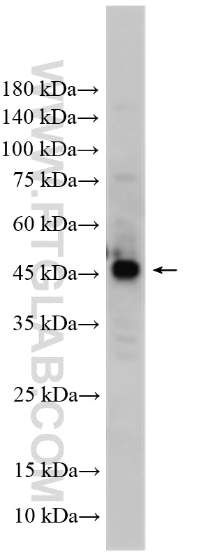 WB analysis of HepG2 using 16371-1-AP Western Blot (WB) analysis of HepG2 cells using GTPBP9 Polyclonal antibody (16371-1-AP)