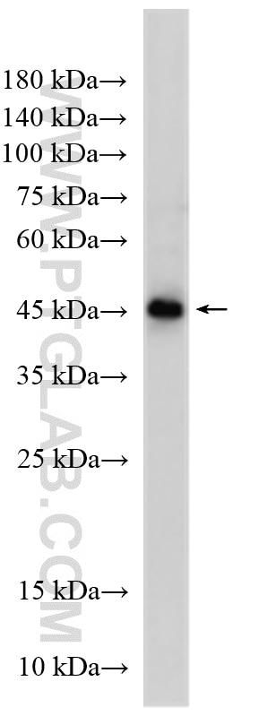 WB analysis of Jurkat using 16371-1-AP Western Blot (WB) analysis of Jurkat cells using GTPBP9 Polyclonal antibody (16371-1-AP)