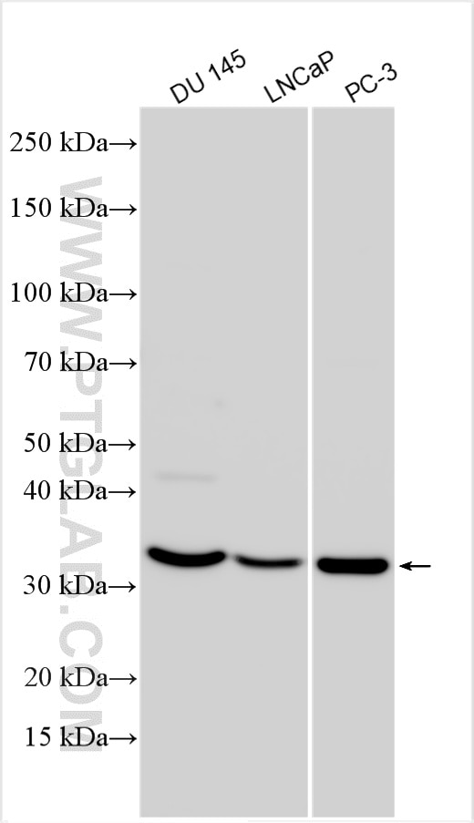 Western Blot (WB) analysis of various lysates using OLAH Polyclonal antibody (17676-1-AP)
