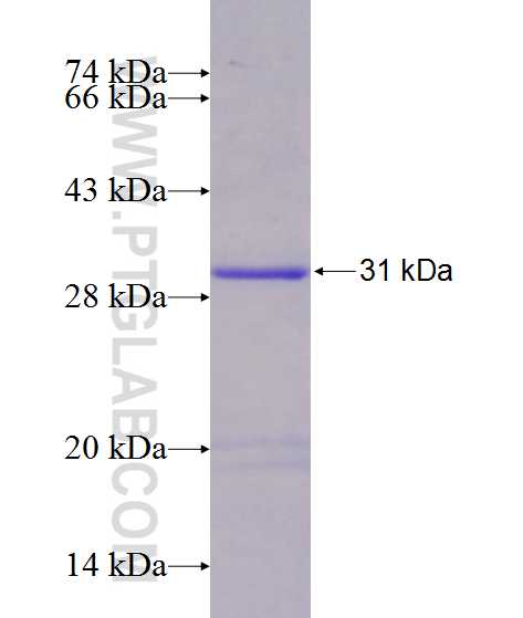 OLAH fusion protein Ag13194 SDS-PAGE