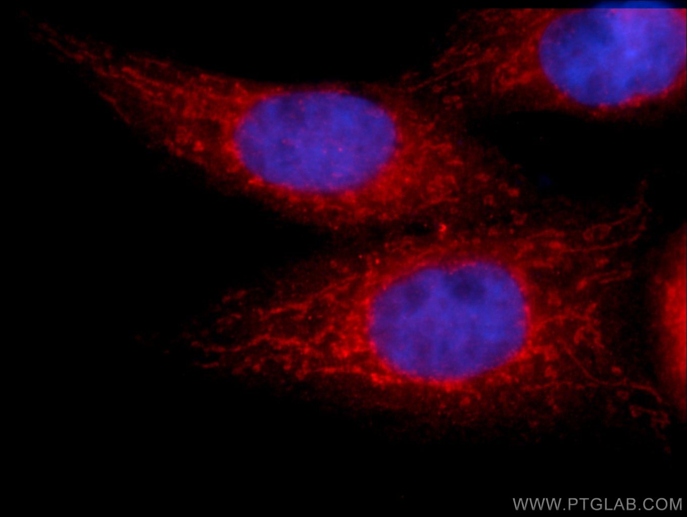 Immunofluorescence (IF) / fluorescent staining of HepG2 cells using hIST1 Polyclonal antibody (19842-1-AP)