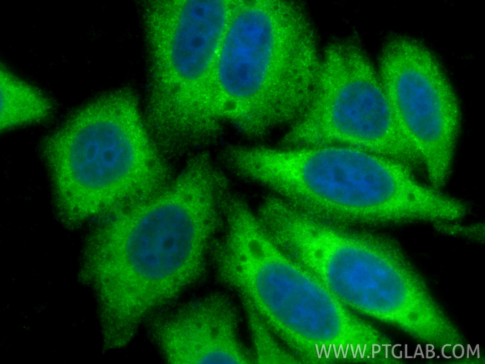 Immunofluorescence (IF) / fluorescent staining of HepG2 cells using hIST1 Polyclonal antibody (19842-1-AP)