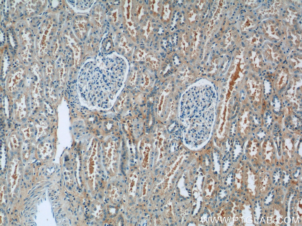 Immunohistochemistry (IHC) staining of human kidney tissue using hIST1 Polyclonal antibody (19842-1-AP)