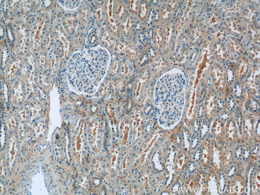 Immunohistochemistry (IHC) staining of human kidney tissue using hIST1 Polyclonal antibody (19842-1-AP)