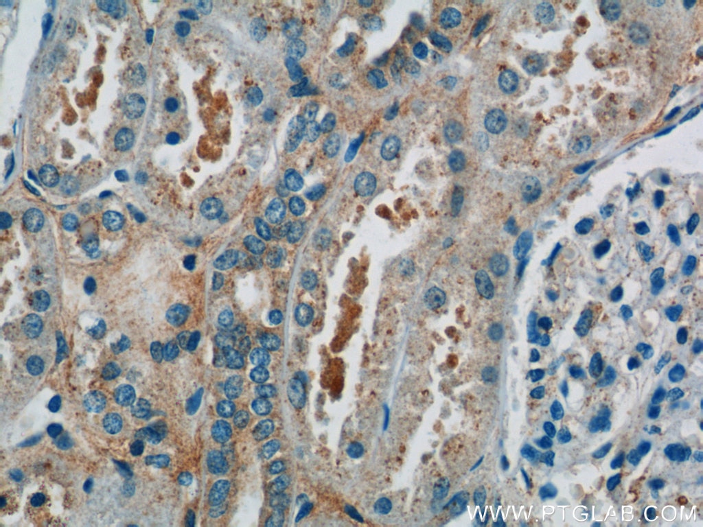 Immunohistochemistry (IHC) staining of human kidney tissue using hIST1 Polyclonal antibody (19842-1-AP)