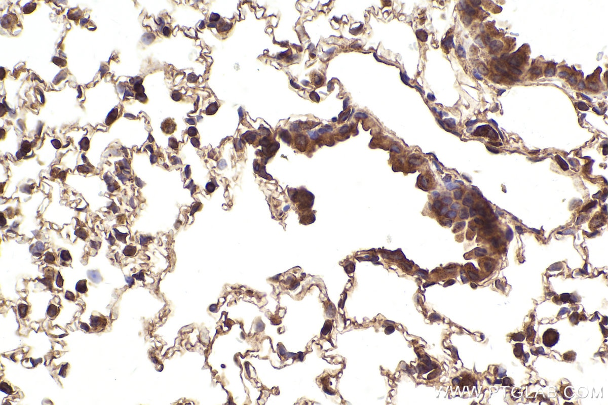 Immunohistochemistry (IHC) staining of mouse lung tissue using hIST1 Polyclonal antibody (19842-1-AP)