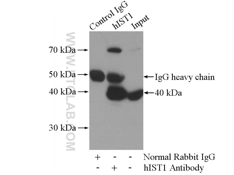 Immunoprecipitation (IP) experiment of mouse liver tissue using hIST1 Polyclonal antibody (19842-1-AP)