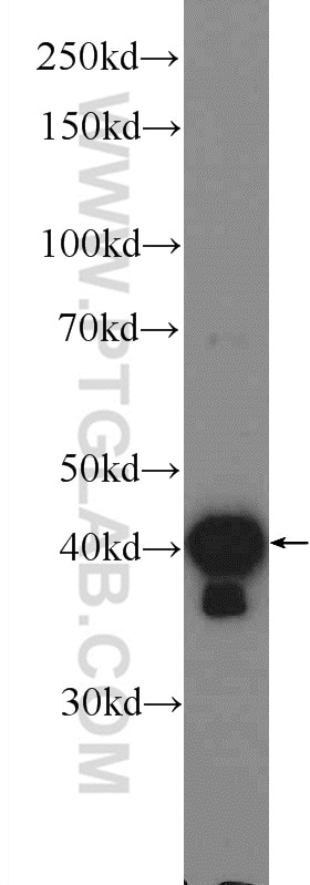 Western Blot (WB) analysis of HeLa cells using hIST1 Polyclonal antibody (19842-1-AP)