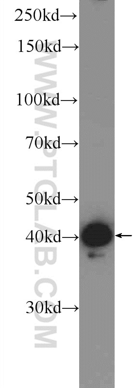 Western Blot (WB) analysis of mouse liver tissue using hIST1 Polyclonal antibody (19842-1-AP)
