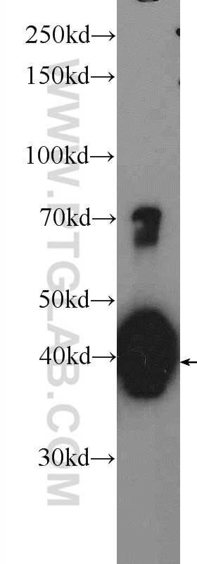 Western Blot (WB) analysis of mouse brain tissue using hIST1 Polyclonal antibody (19842-1-AP)