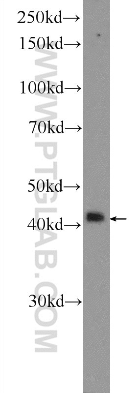 Western Blot (WB) analysis of HeLa cells using hIST1 Polyclonal antibody (19842-1-AP)