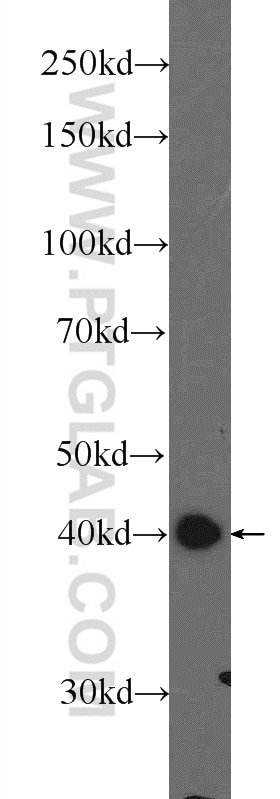 Western Blot (WB) analysis of PC-3 cells using hIST1 Polyclonal antibody (19842-1-AP)