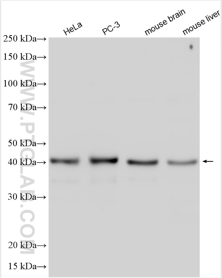 Western Blot (WB) analysis of various lysates using hIST1 Polyclonal antibody (19842-1-AP)